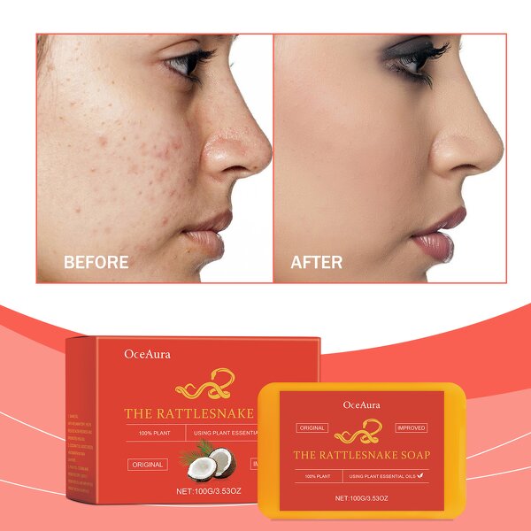 Facial Soap Manufacturer - 100% Organic Natural Plant Cleansing Control Oil Acne Nourish Skin Top Seller