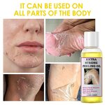 Peeling Oil Manufacturer - Private Label Extra Strong Peeling Oil Scar Remove Stretch Marks Whitening Yellow