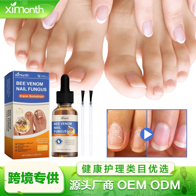 Nail Treatment Solution Manufacturer - Hot Selling Custom Private Label Soft Nail Thick Nail Antibacterial
