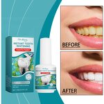 Tooth Whitening Solution Manufacturer - Hot Sale Clean Teeth Stains Oral Hygien Anti-pigmentation Natural Instant