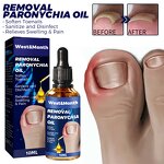 Nail Relief Oil Manufacturer - Wholesale WEST MONTH Nail Care Fast Effective Removal Anti Paronychia Relief 10ml