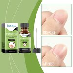 Nail Care Liquid Manufacturer - Wholesale Natural Effective Promote Nail Growth Improvement Fungal Nourishing