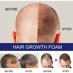Hair Growth Foam Manufacturer - East Moon Men Deep Repair Hair Root Follicle Promotes Fast Growing Castor Argan Oil