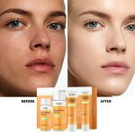 Turmeric Skincare Set Manufacturer - Vegan Private Label Turmeric Nicotinamide Anti Acne Brightening Organic OEM