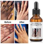 Dark Knuckles Serum Manufacturer - Fast Whitening Hand Knuckle Elbows Knee Stains Remover OEM Private Label