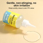 Acne Toner Essence Manufacturer - Hot Selling Salicylic Acid Removing Beauty Salons Acid Acne Wholesale OEM