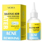 Acne Toner Essence Manufacturer - Hot Selling Salicylic Acid Removing Beauty Salons Acid Acne Wholesale OEM