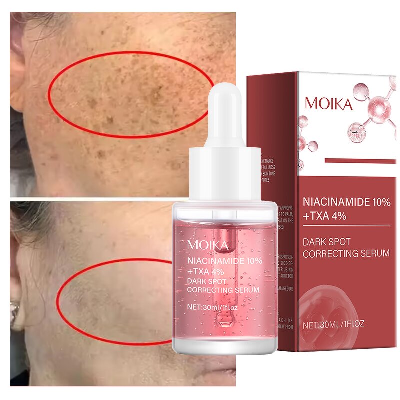 Whitening Serum Manufacturer - 10% Niacinamide 4% Tranexamic Acid Dark Spots Correcting Sensitive Skin