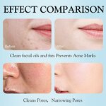 Face Wash Manufacturer - Hydrating Cleansing Mousse Pore Oil Makeup Removing Vitamin C Private Label