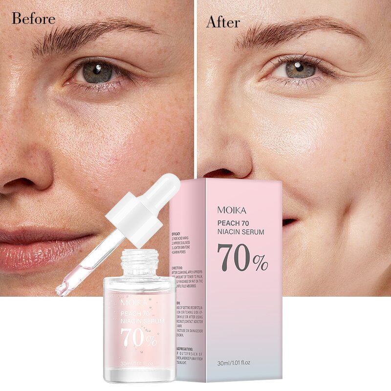 Niacin Face Serum Manufacturer - Peach 70 Niacin Korean Anti Aging Centella Asiatica Extract Oem