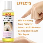 Peeling Oil Manufacturer - OEM Body Skin Care Yellow Dark Spots Removers Strong Knuckle Whitening