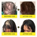 Hair Growth Serum Manufacturer - Anti Hair Loss Ginger Oil Regrowth Care Vitamin B5 Biotin Men Women