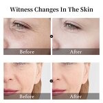 Vitamin C Serum Manufacturer - 5 in 1 Whitening Anti Age 30% Vitamin C 5% Niacinamide 10% Vitamin E