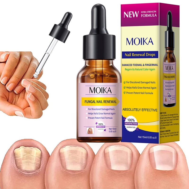 Nail Repair Serum Manufacturer - OEM Manufacturer Wholesale Natural 15ml Anti Bacterial Fungal
