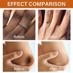 Dark Knuckles Whitening Serum Manufacturer - Fast Whitening Hand Knuckle Elbows Knee Stains Remover OEM Private Label