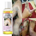 Peeling Oil Manufacturer - OEM Body Skin Care Yellow Dark Spots Removers Strong Knuckle Whitening