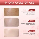 Dark Spot Serum Manufacturer - Hyaluronic Acid Niacinamide 10% + TXA 4% Hyperpigmentation Correcting Korean OEM