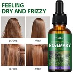 Scalp Treatment Oil Manufacturer - 100% Natural Organic Rosemary Castor Almond Men Women Scalp Private Label