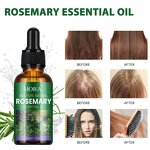 Scalp Treatment Oil Manufacturer - 100% Natural Organic Rosemary Castor Almond Men Women Scalp Private Label