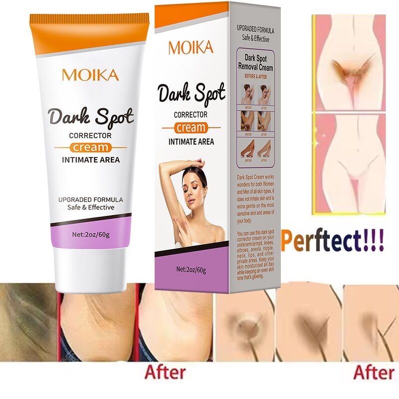 Body Whitening Cream Manufacturer - Private Label Inner Thighs Women Private Parts Dark Spots Eraser