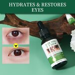 Eye Serum Manufacturer - Wholesale Organic Removal Fine Line Dark Circle Lifting Firming Aloe Vera