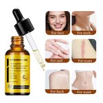 Massage Oil Manufacturer - Private Label Oem Natural Organic Repair Scar Stretch Marks Wrinkle Argan Oil