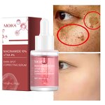 Niacinamide Serum Manufacturer - Ready Ship 10% Lightening Whitening Dark Spot Removal 30ml