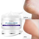 Urea Cream Manufacturer - Dry Cracked Feet Elbows Knees Repair 40% Urea Dead Skin Remover Body Care