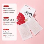 Acne Patch Manufacturer - Korean 36 Patches Hydrocolloid Facial Acne Products Dots for Spots