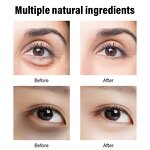 Eye Cream Manufacturer - Private Label Eye Bag Remover Lift Fast Anti Aging Anti-wrinkle Under Skin