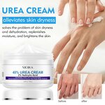 Urea Cream Manufacturer - Dry Cracked Feet Elbows Knees Repair 40% Urea Dead Skin Remover Body Care