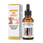 Dark Knuckles Serum Manufacturer - Fast Whitening Hand Knuckle Elbows Knee Stains Remover OEM Private Label