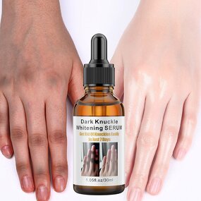 Dark Knuckles Whitening Serum Manufacturer - Fast Whitening Hand Knuckle Elbows Knee Stains Remover OEM Private Label