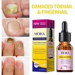 Nail Treatment Serum Manufacturer - Strong Effective 7 Days Nails Fungus Repair Nourishing Damage Natural