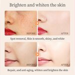 Whitening Serum Manufacturer - Ceramide Freckle Remove Melasma Dark Spots Vitamin C Private Label