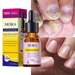 Nail Repair Serum Manufacturer - 15ml Clean Whiten Nourish Fungal Treatment Toe Nail Fungus
