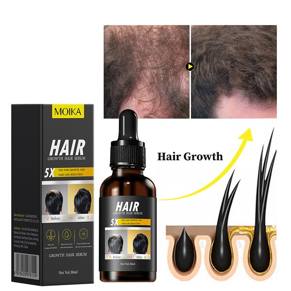 Hair Growth Serum Manufacturer - 100% Private Label Rosemary Mint Scalp Strengthening