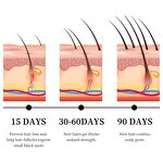 Hair Growth Serum Manufacturer - 100% Private Label Rosemary Mint Scalp Strengthening