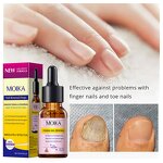 Nail Treatment Serum Manufacturer - Strong Effective 7 Days Nails Fungus Repair Nourishing Damage Natural