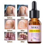 Nail Treatment Serum Manufacturer - Strong Effective 7 Days Nails Fungus Repair Nourishing Damage Natural
