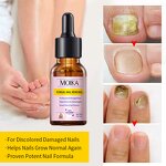 Nail Treatment Serum Manufacturer - Strong Effective 7 Days Nails Fungus Repair Nourishing Damage Natural