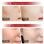 Anti-Aging Serum Manufacturer - Glutathione Niacinamide Wrinkles Dark Spots Vitamin C Retinol B3 OEM