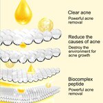 Acne Toner Essence Manufacturer - Hot Selling Salicylic Acid Removing Beauty Salons Acid Acne Wholesale OEM