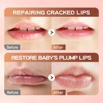 Lip Balm Manufacturer - Children's Calendula Anti-Cracking & OEM