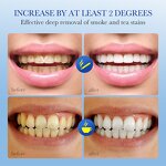 Toothpaste Manufacturer - Natural Herbal Mint for Smoke Stains & OEM