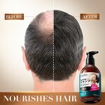 Shampoo Manufacturer - Organic Anti-Dandruff Anti-Hair Loss & OEM