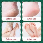 Foot Mask Manufacturer - Christmas Nicotinamide Whitening & OEM