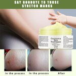 Maternity Cream - Skin Repair Stretch Mark Removal & OEM