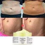 Maternity Cream - Skin Repair Stretch Mark Removal & OEM