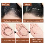 Batana Oil - 100% Pure Unrefined for Hair Growth & Private Label